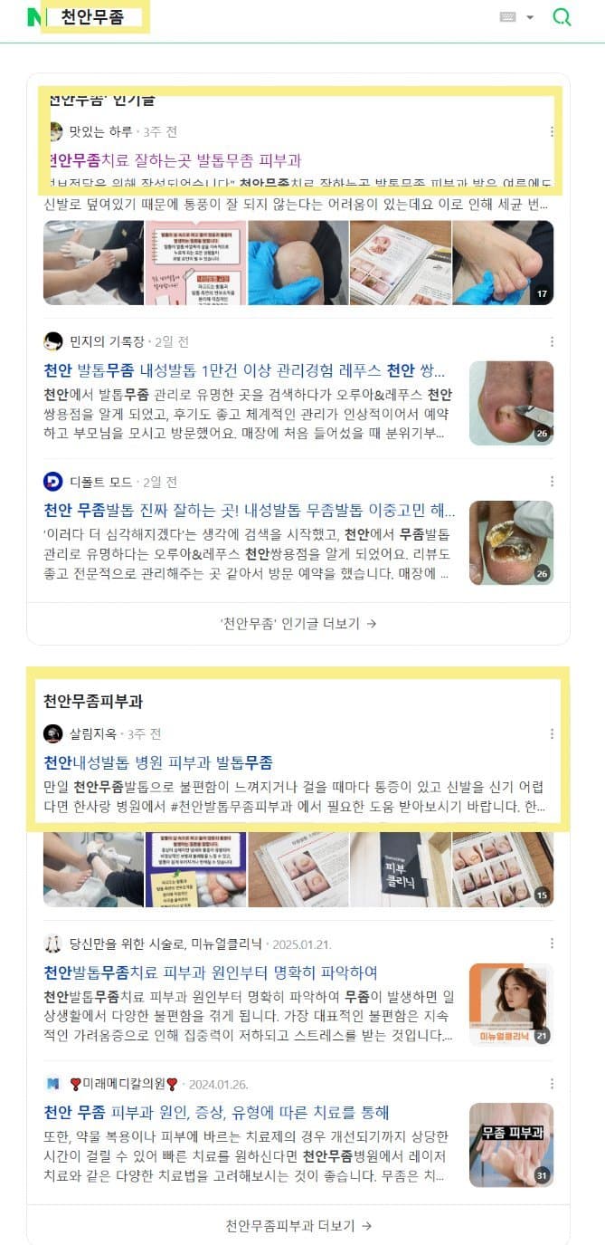 '천안무좀' 네이버 검색 결과 상위 노출 캡처